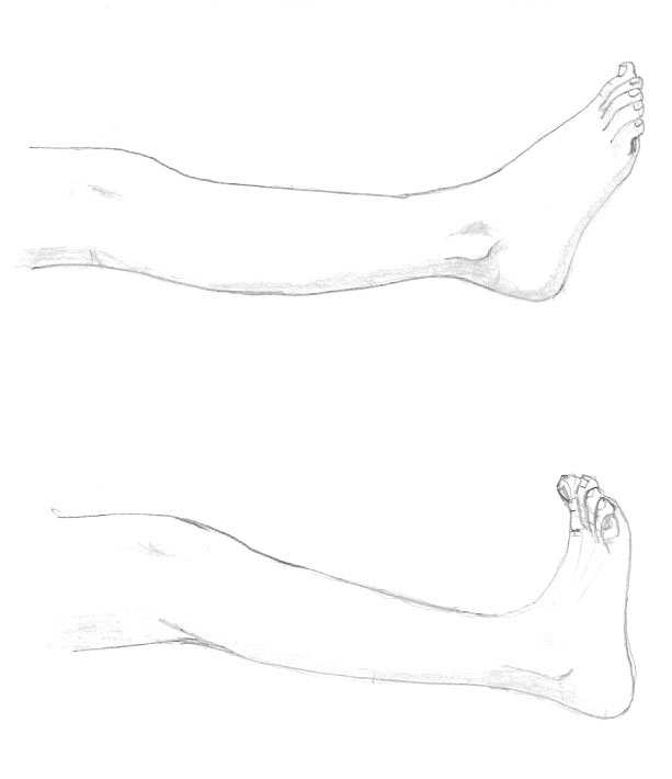estiramientos-tendon-aquiles-1-vidaterapia
