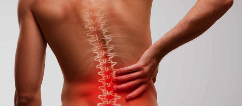 sindrome facetario lumbar dr. jordi jimenez